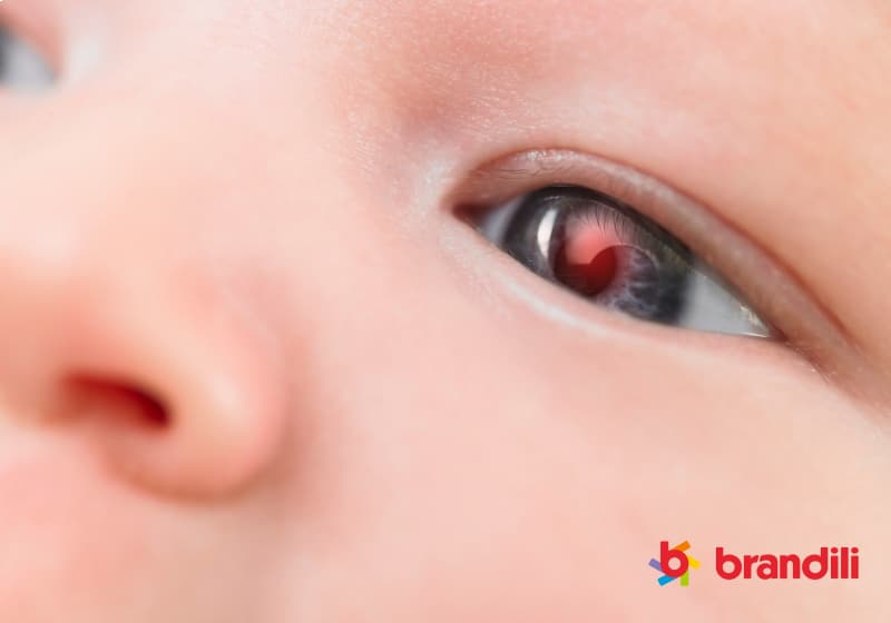 close-up do olho do bebê com luz vermelha 