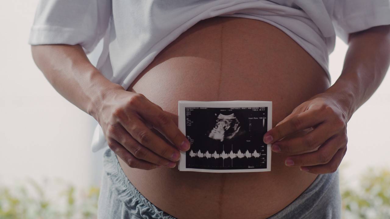 mulher com 18 semanas de gestação segurando uma ultrassom em frente da barriga