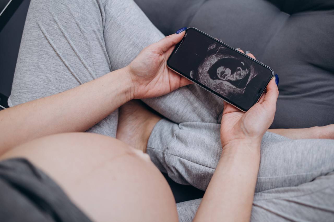 mãe olhando a ultrassom de um bebê de 39 semanas